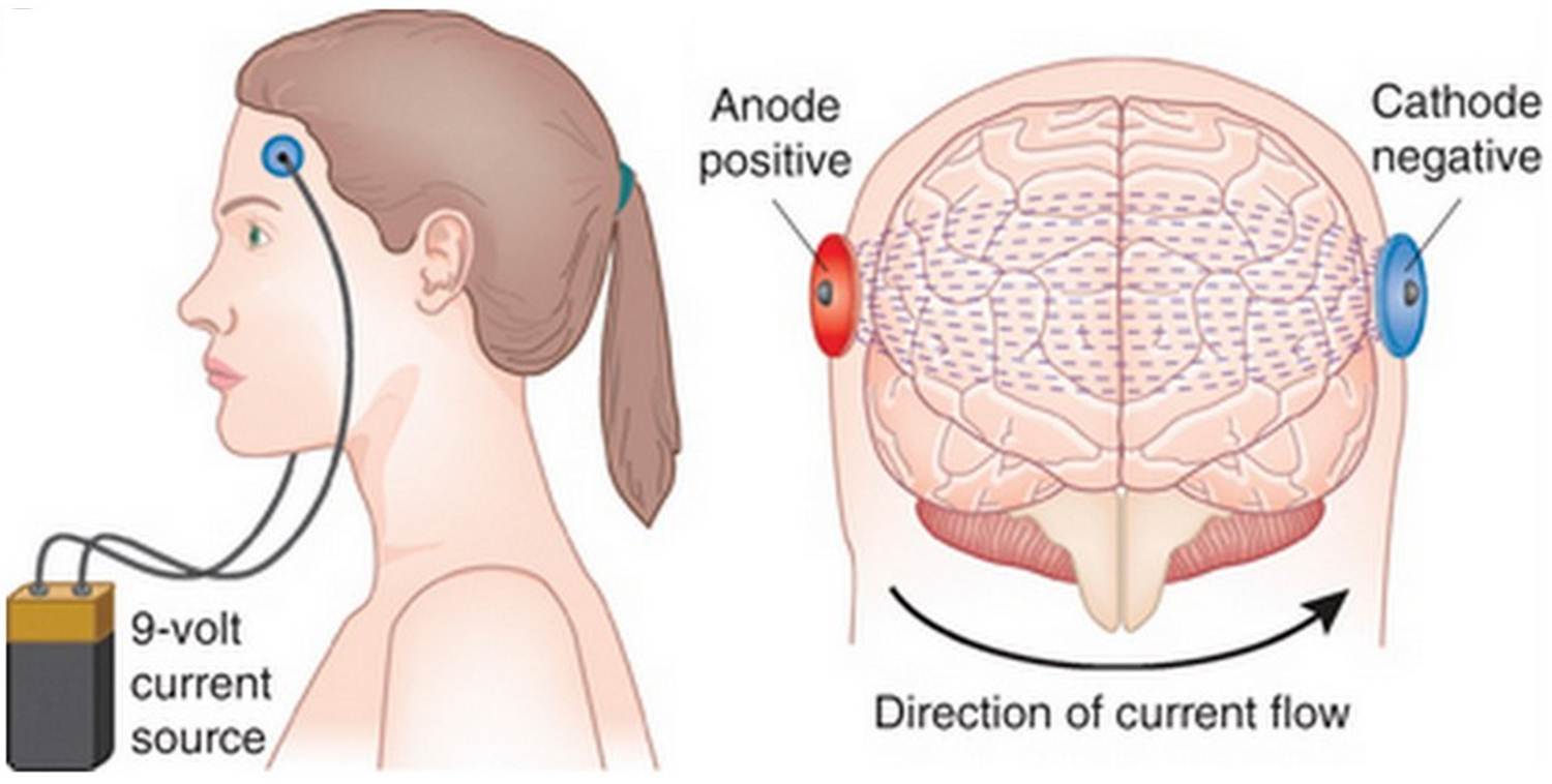 transcranial-direct-current-stimulation-hce-wiki-the-human